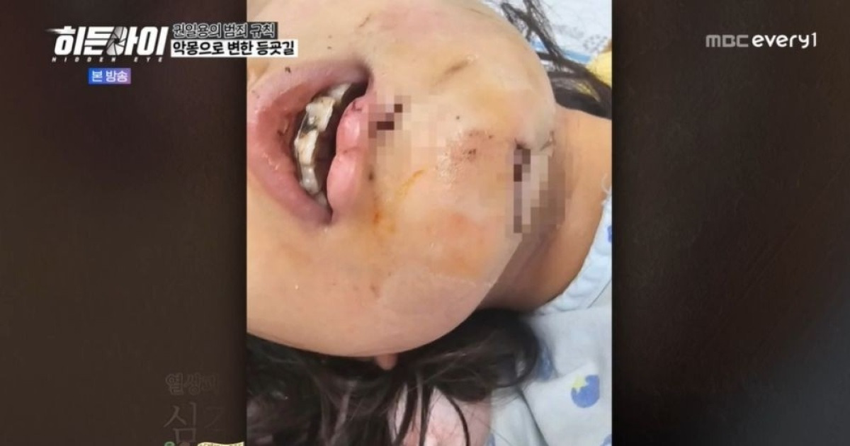 게시글 대표 이미지