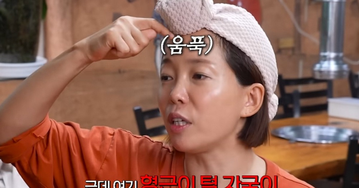 '연매출 50억' 정이랑, 성형 부작용 고백 "남편 턱자국에 이마 파여" [RE:뷰]