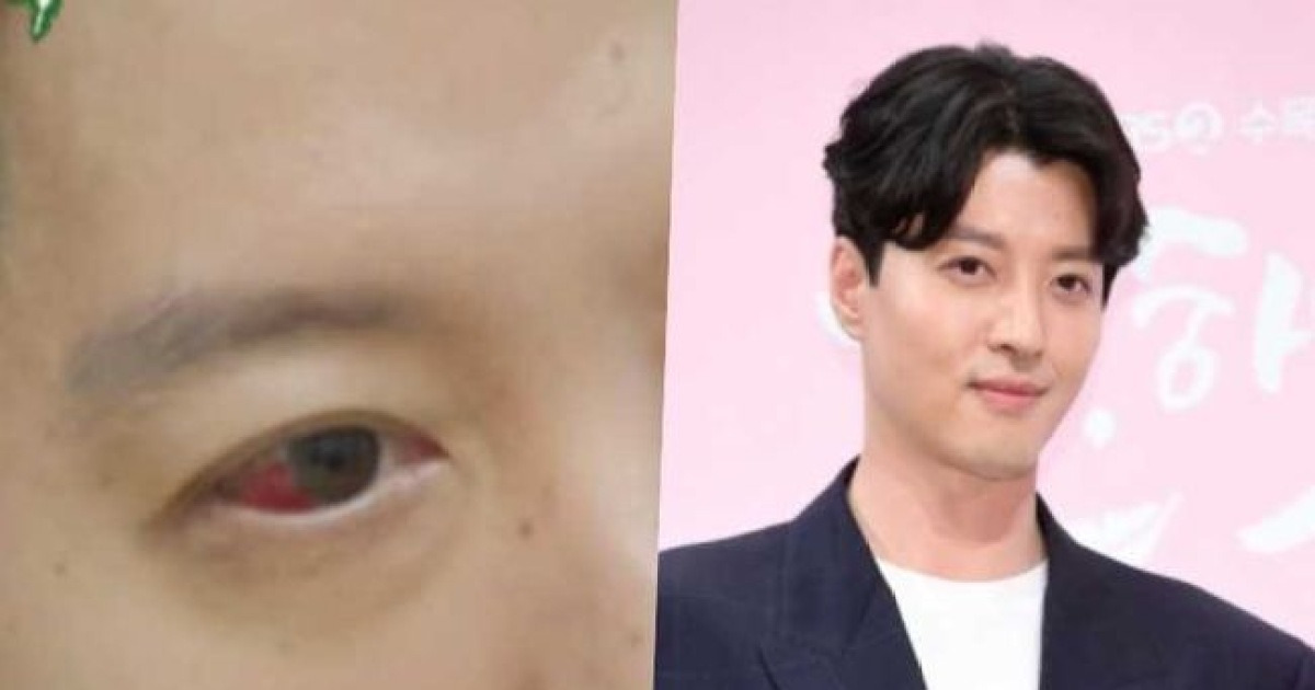 '1% 희귀병’ 충격 진단…이동건, 충혈된 새빨간 눈 상태 어쩌나 ('미우새') [Oh!쎈 예고]