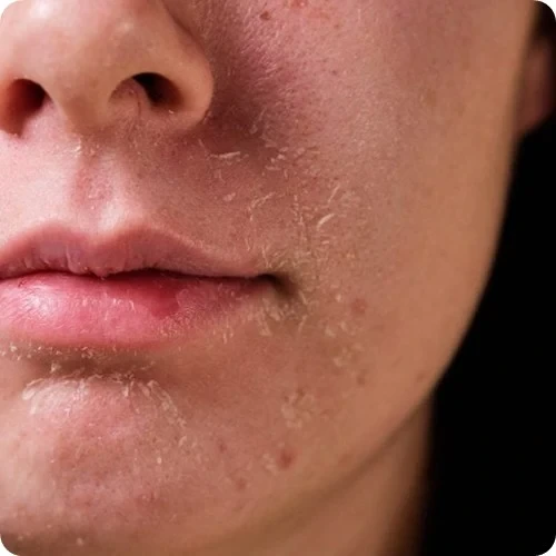 피부 장벽 무너짐 증상 5가지 체크리스트와 회복 방법 - 뷰티인사이트