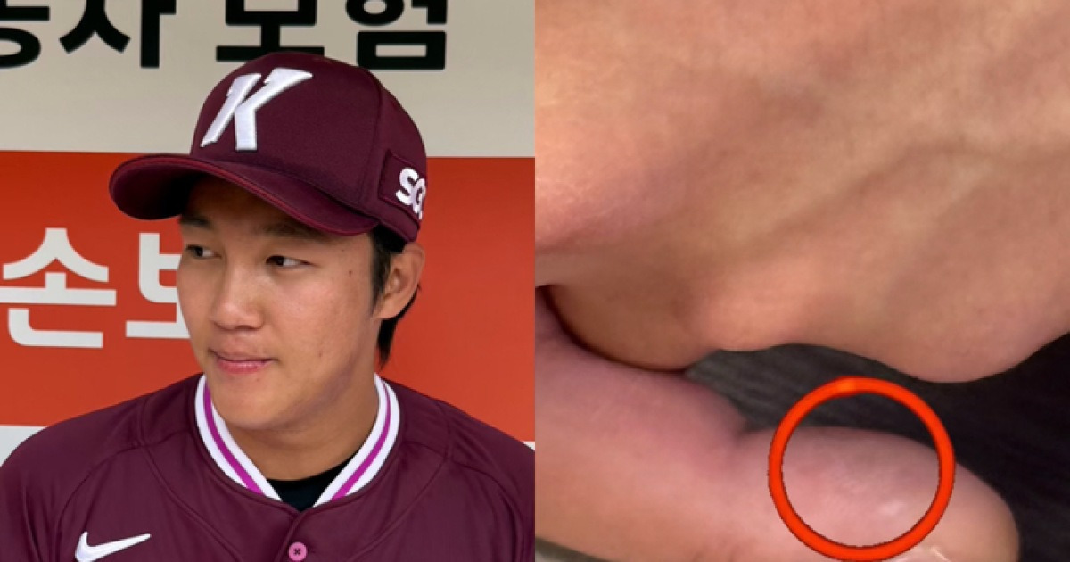 게시글 대표 이미지