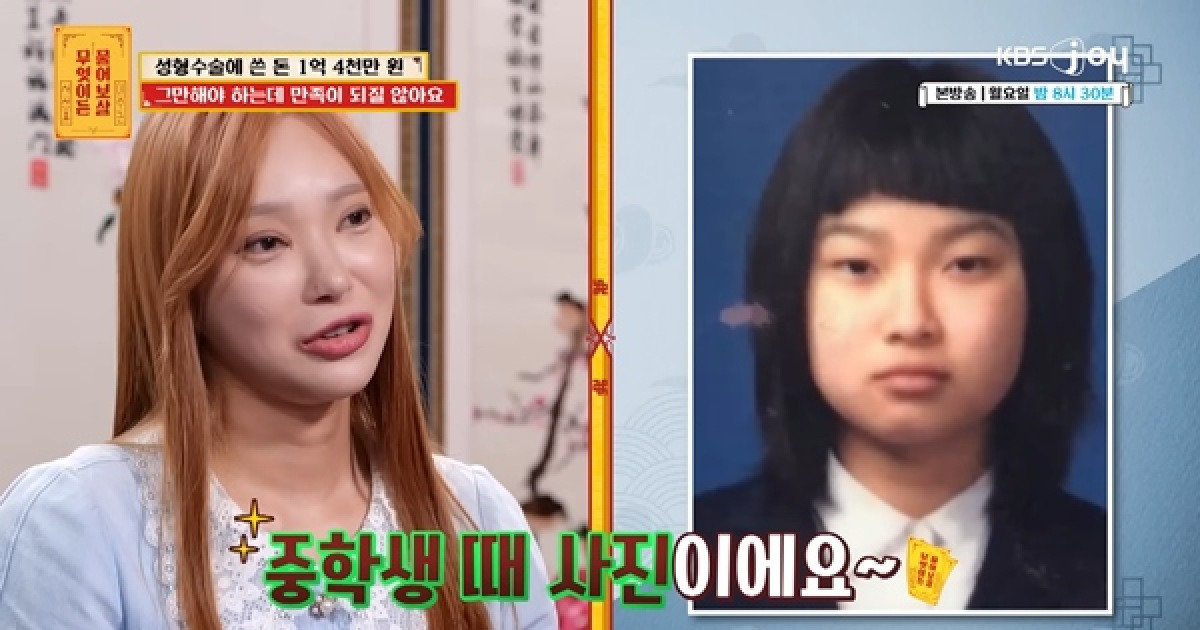 성형 중독女, 얼굴에 1억4000만 원…"눈·코·윤곽 다 했는데 만족 못 해" ('물어보살')