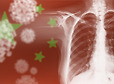 중국 코로나 위중환자 90% 퇴원 후에도 폐 손상