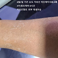 '자외선 관리 잘못하면' 글에 포함된 이미지