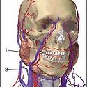 sialogram