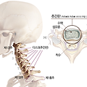 경추7번 -젓가락질 힘들때