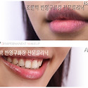 반영구화장 전문클리닉 조앤박의 틴트입..