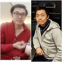 재남 파나스타 복용 전,후 모습