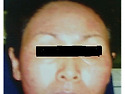 얼굴라인이 달라졌죠??