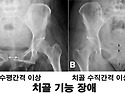 쉽게 공부하는 산후관리 - 치골의 문제와 검사 방법