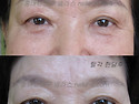 자연눈썹-연세가 있으신경우