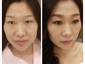 【before /after】입체감..