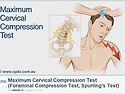 목뼈 압박검사(Cervical compression test)