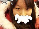 쌍수한지 한달됫어요^*^