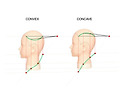 convex , concave 1..