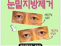 동안의 최고 시술 눈밑지방재배치 로 황금연휴를 시작해 보세요