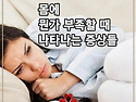 몽 증상