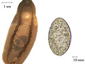 Clinostomum complanatum.