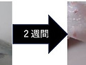무지개송어의 비치사성 피부염 (Rash..