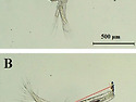 poly-&beta;-hydroxybutyrate (PHB..