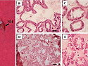 Photobacterium damselae sub..