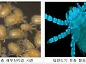 쯔쯔가무시증 유행철 온다..
