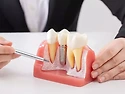 임플란트가 20만 원? &lsquo;먹..