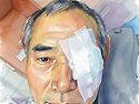 망막박리 수술