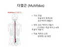 다열근 (multifidus muscle)