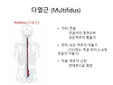 다열근 (multifidus muscle)