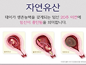 오병깨치 "임신확률은 높이..