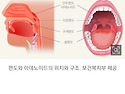 편도 아데노이드의 재발견