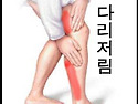 다리저림