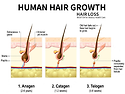 탈모 원인을 알아야 예방이 가능하다.., 성장주기와 생리적 기전