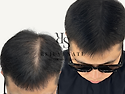 익산두피문신 상상 그 이상..