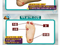 발바닥지압으로 어깨통증 치료하기