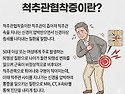 척추관 협착증으로 인한 허리 통증특수자석 자가치료 상담