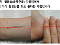  과민성 대장 증상으로인한 변비 설사 아랫배 불쾌감 제니센 터치 방법