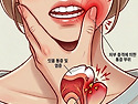 단단한 음식을 씹다가 치아가 흔들린 증상 특수자석 자가치료상담