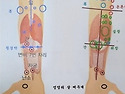 뇌경색 치료와 예방 척추관 협착증 다리통증 제니센 터치 자가치료 상담