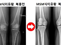 글루타치온, 콜라겐과는 비교도 안되는 MSM 식이유황 놀라운 효능 9가지!