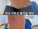 마포 발각질케어,..