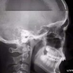 엑스레이 찍다가 실수로 재채기함 이미지