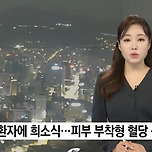 당뇨 환자에 희소식...피부 부착형 혈당 센서 개발 이미지