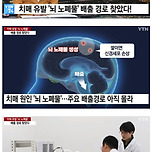 치매 연구 근황 👉뇌 노폐물 배출경로 찾음 이미지