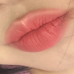 입술 필러 이미지