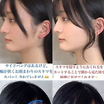 이제 더듬이 앞머리가 이상한 걸 깨달은 일본.jpg 이미지