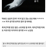 족저근막염 내버려두면 발바닥에 뿔도 생김.jpg 이미지