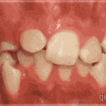 치아교정의 위대함 이미지