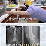 밀가루 중독의 위험성 이미지